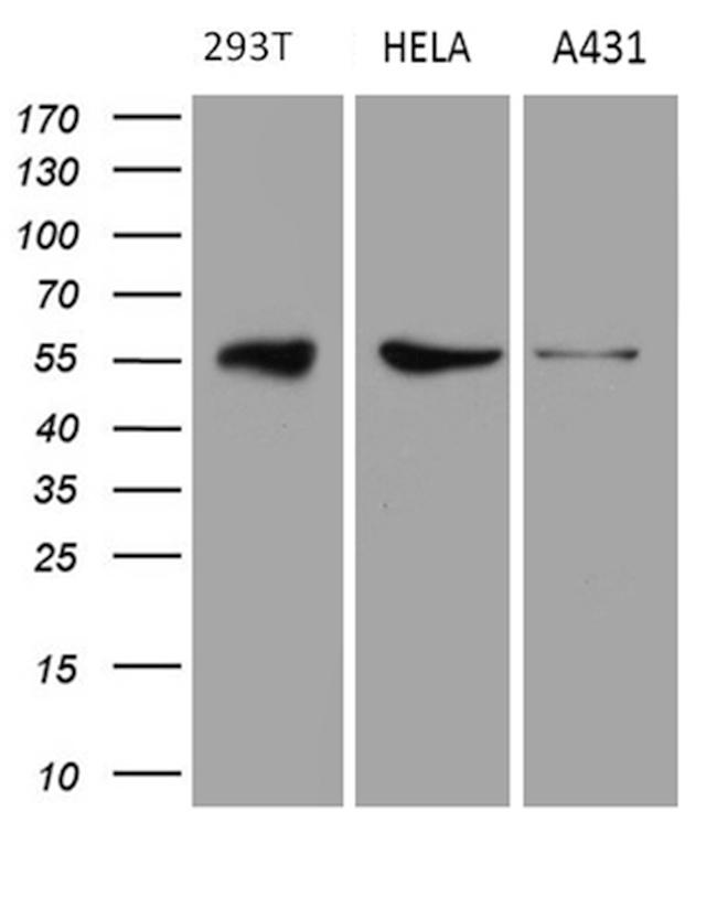 RAB3IP Antibody in Western Blot (WB)