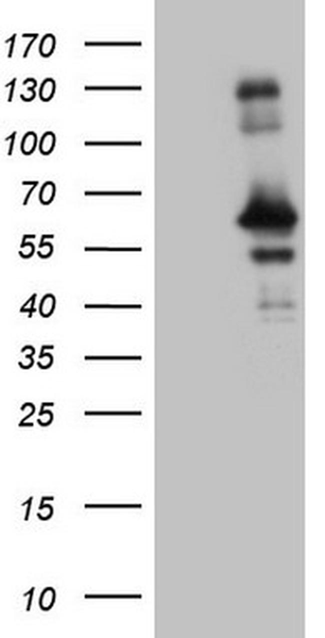 RAB3IP Antibody in Western Blot (WB)