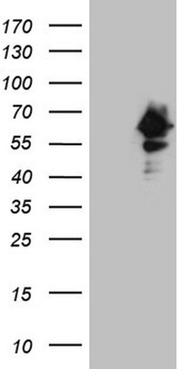 RAB3IP Antibody in Western Blot (WB)