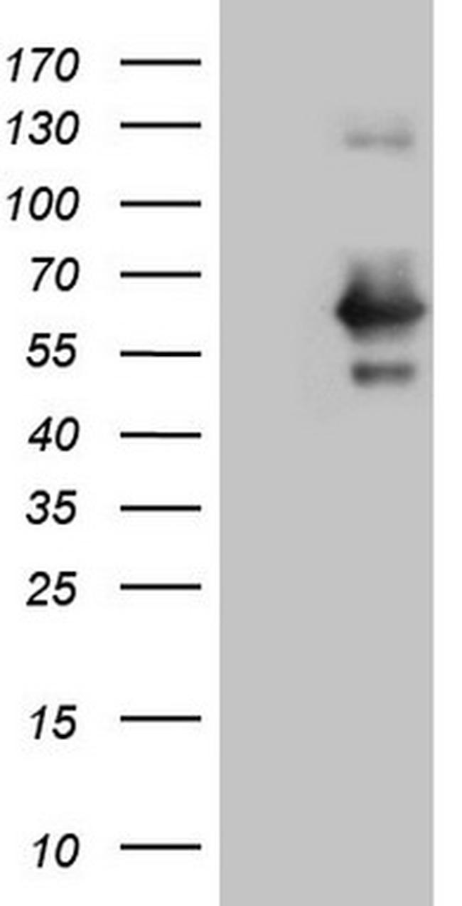 RAB3IP Antibody in Western Blot (WB)