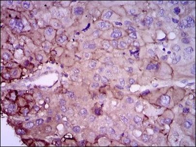 Rab4 Antibody in Immunohistochemistry (Paraffin) (IHC (P))