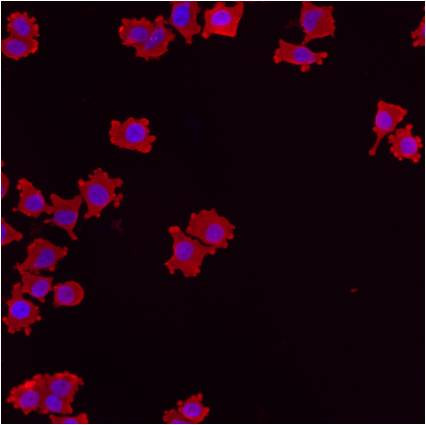 RAB5 Antibody in Immunocytochemistry (ICC/IF)