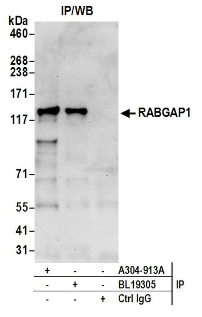 RABGAP1 Antibody in Immunoprecipitation (IP)