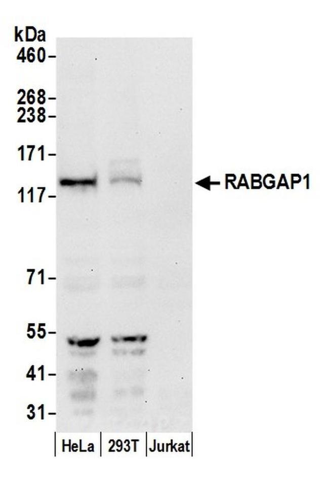 RABGAP1 Antibody in Western Blot (WB)
