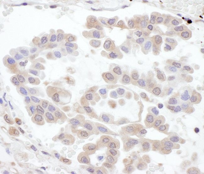 RABGEF1 Antibody in Immunohistochemistry (IHC)