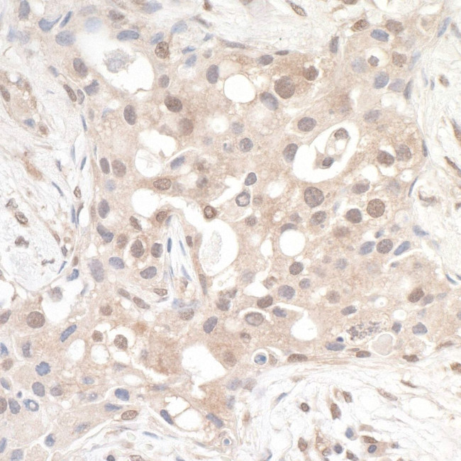 RABGEF1 Antibody in Immunohistochemistry (IHC)