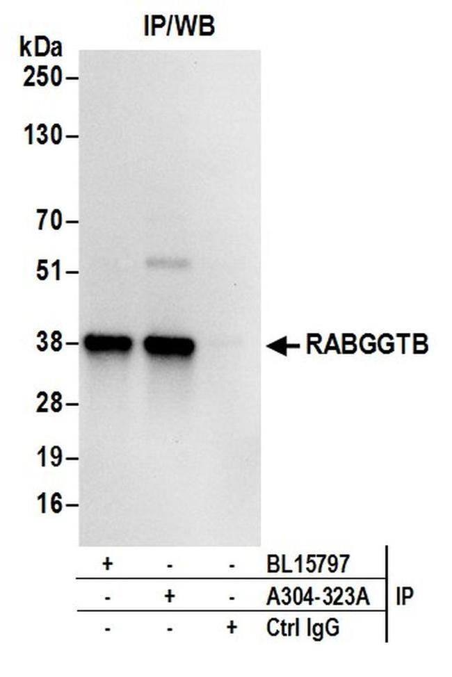 RABGGTB Antibody in Western Blot (WB)