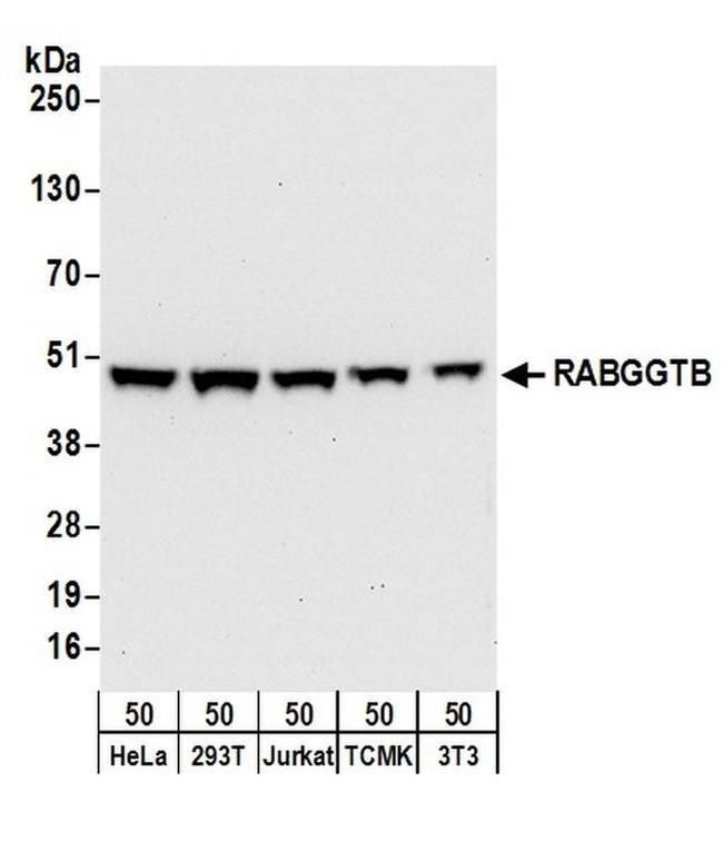 RABGGTB Antibody in Western Blot (WB)