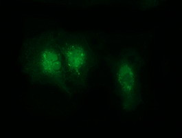 RABL2A Antibody in Immunocytochemistry (ICC/IF)