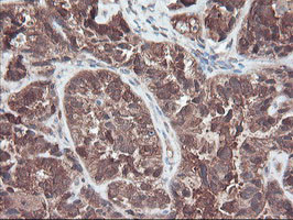 RABL2A Antibody in Immunohistochemistry (Paraffin) (IHC (P))