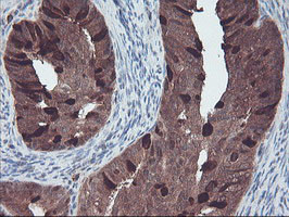 RABL2A Antibody in Immunohistochemistry (Paraffin) (IHC (P))