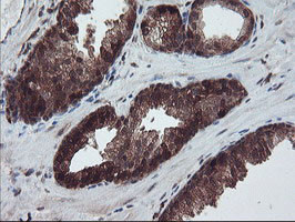 RABL2A Antibody in Immunohistochemistry (Paraffin) (IHC (P))