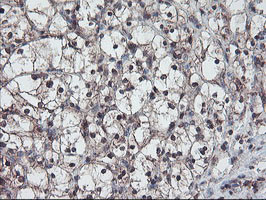 RABL2A Antibody in Immunohistochemistry (Paraffin) (IHC (P))