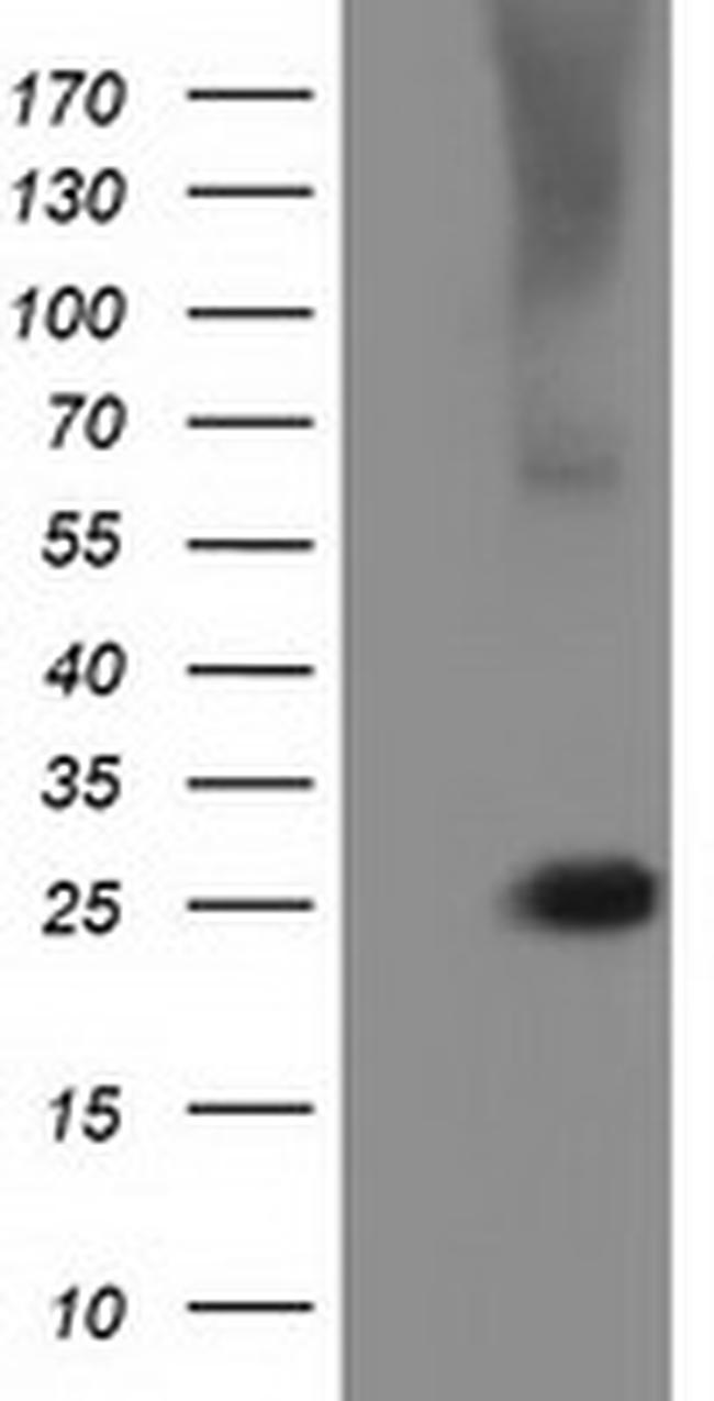 RABL2A Antibody in Western Blot (WB)