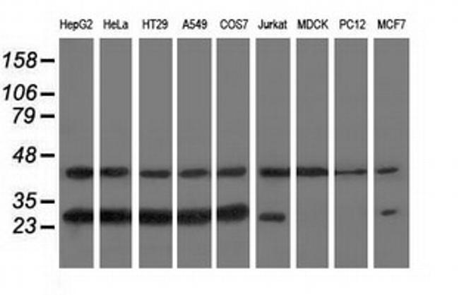 RABL2A Antibody in Western Blot (WB)