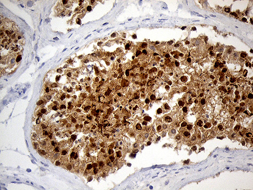 RACGAP1 Antibody in Immunohistochemistry (Paraffin) (IHC (P))