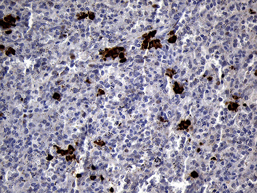 RACGAP1 Antibody in Immunohistochemistry (Paraffin) (IHC (P))