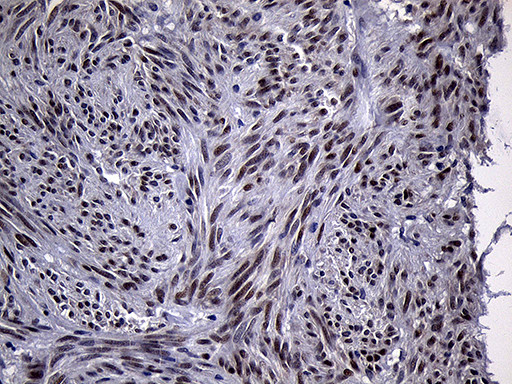 RACGAP1 Antibody in Immunohistochemistry (Paraffin) (IHC (P))