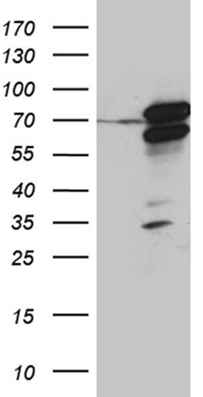 RACGAP1 Antibody in Western Blot (WB)