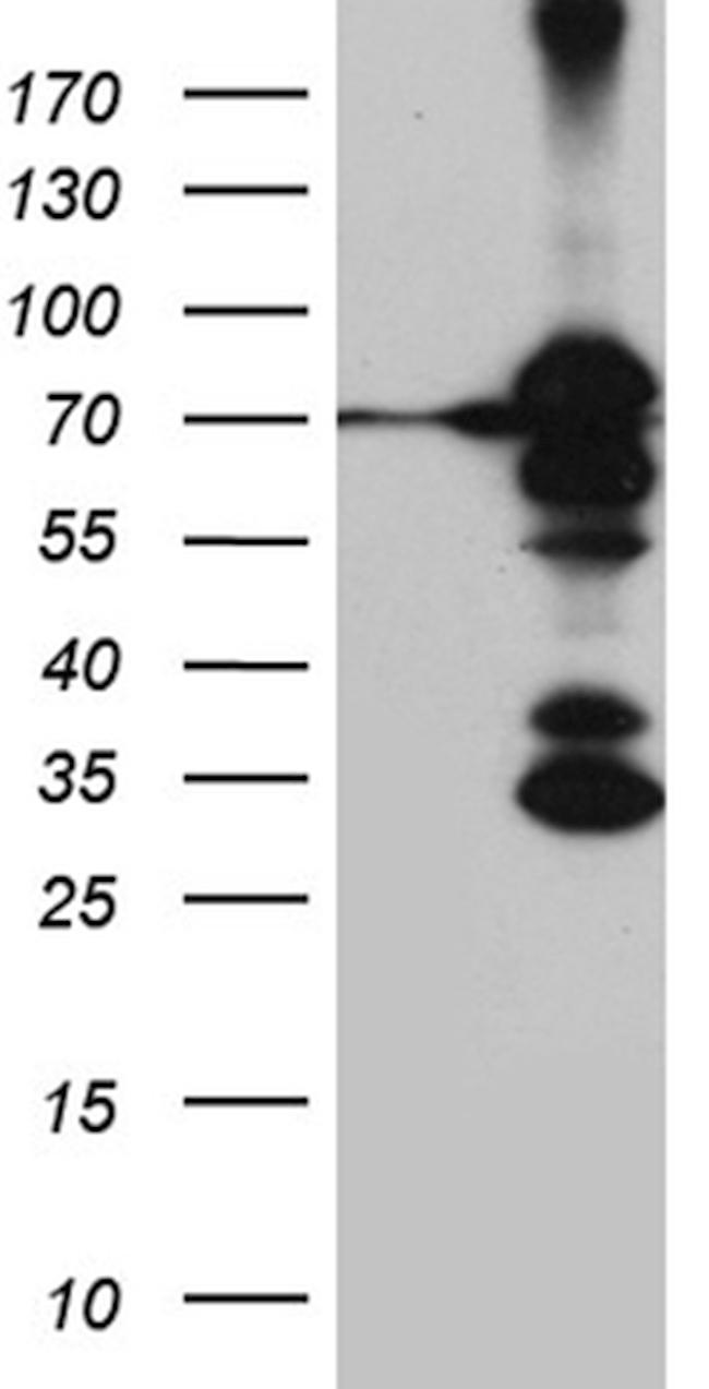 RACGAP1 Antibody in Western Blot (WB)