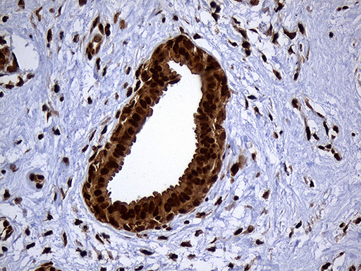 RAD21 Antibody in Immunohistochemistry (Paraffin) (IHC (P))