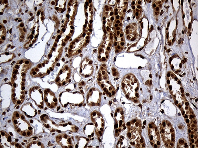 RAD21 Antibody in Immunohistochemistry (Paraffin) (IHC (P))