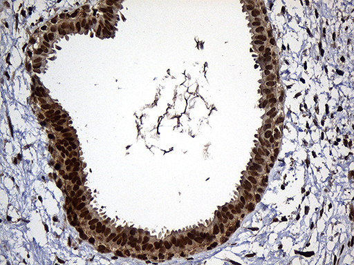 RAD21 Antibody in Immunohistochemistry (Paraffin) (IHC (P))