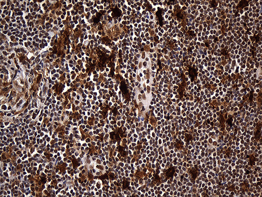 RAD21 Antibody in Immunohistochemistry (Paraffin) (IHC (P))