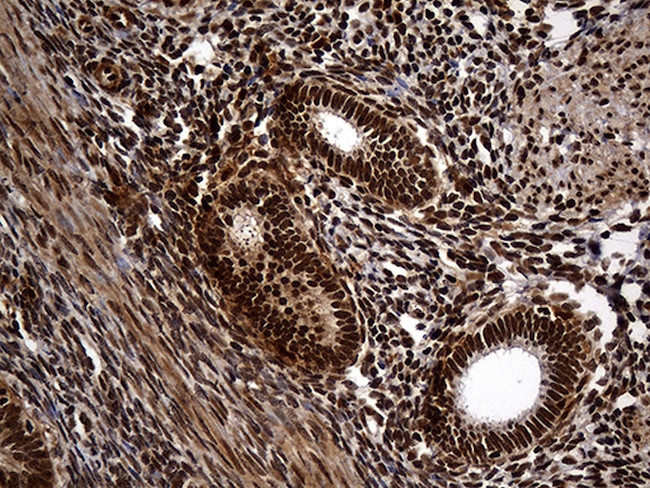 RAD21 Antibody in Immunohistochemistry (Paraffin) (IHC (P))