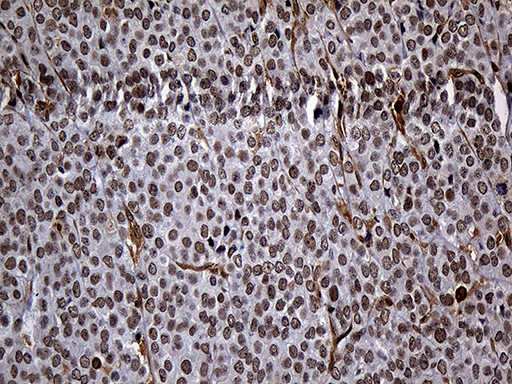 RAD21 Antibody in Immunohistochemistry (Paraffin) (IHC (P))