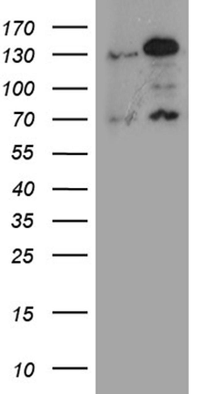 RAD21 Antibody in Western Blot (WB)