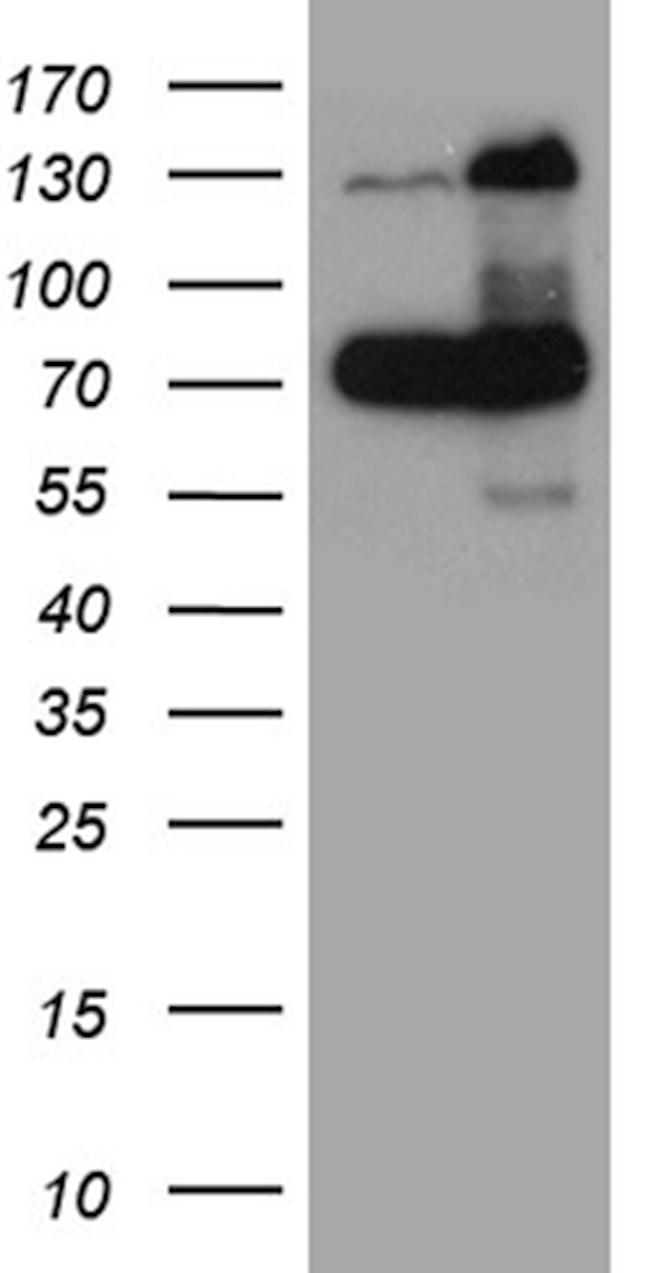 RAD21 Antibody in Western Blot (WB)