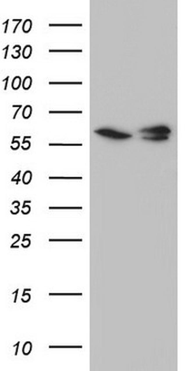 RAD23B Antibody in Western Blot (WB)