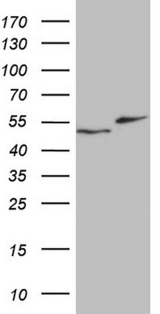 RAD23B Antibody in Western Blot (WB)