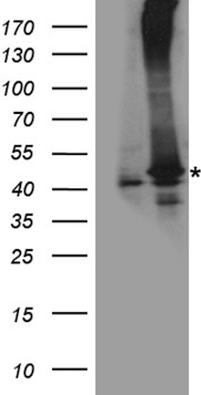 RAD51 Antibody in Western Blot (WB)