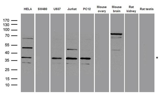 RAD51 Antibody in Western Blot (WB)