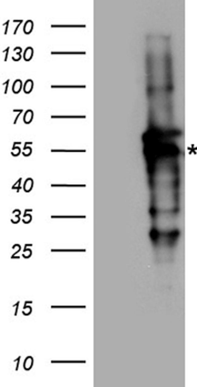 RAD52 Antibody in Western Blot (WB)