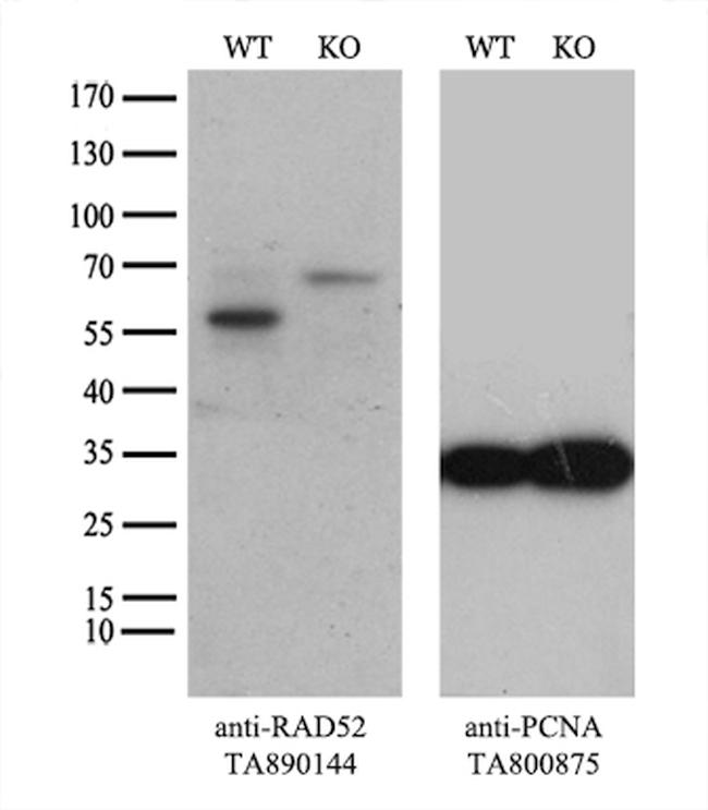 RAD52 Antibody in Western Blot (WB)