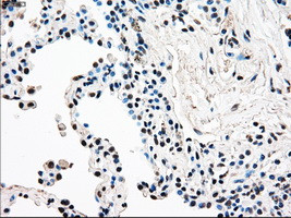 RAD9A Antibody in Immunohistochemistry (Paraffin) (IHC (P))