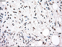 RAD9A Antibody in Immunohistochemistry (Paraffin) (IHC (P))