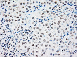 RAD9A Antibody in Immunohistochemistry (Paraffin) (IHC (P))