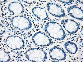 RAD9A Antibody in Immunohistochemistry (Paraffin) (IHC (P))