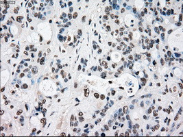 RAD9A Antibody in Immunohistochemistry (Paraffin) (IHC (P))