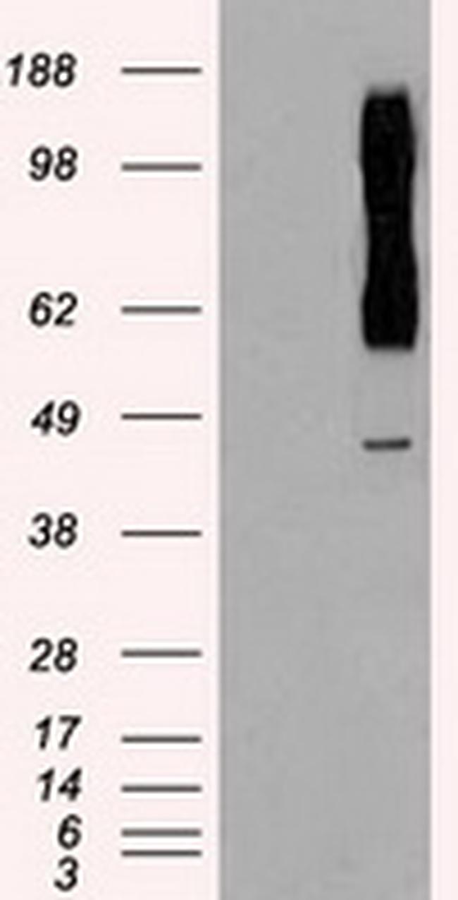 RAD9A Antibody in Western Blot (WB)