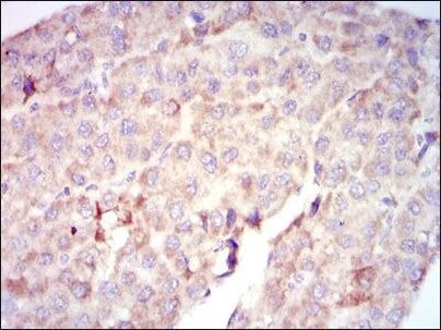 c-Raf Antibody in Immunohistochemistry (Paraffin) (IHC (P))