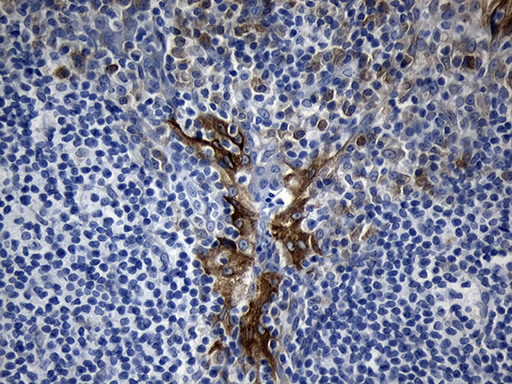 MOK Antibody in Immunohistochemistry (Paraffin) (IHC (P))