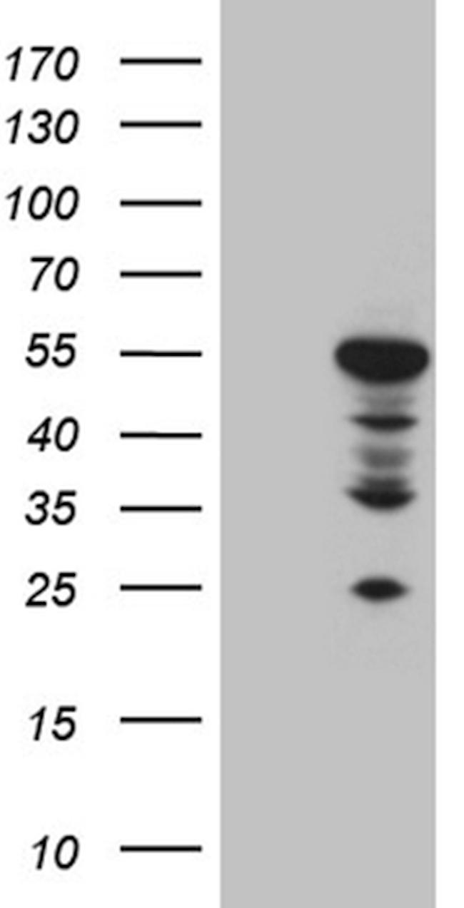 RAGE Antibody in Western Blot (WB)