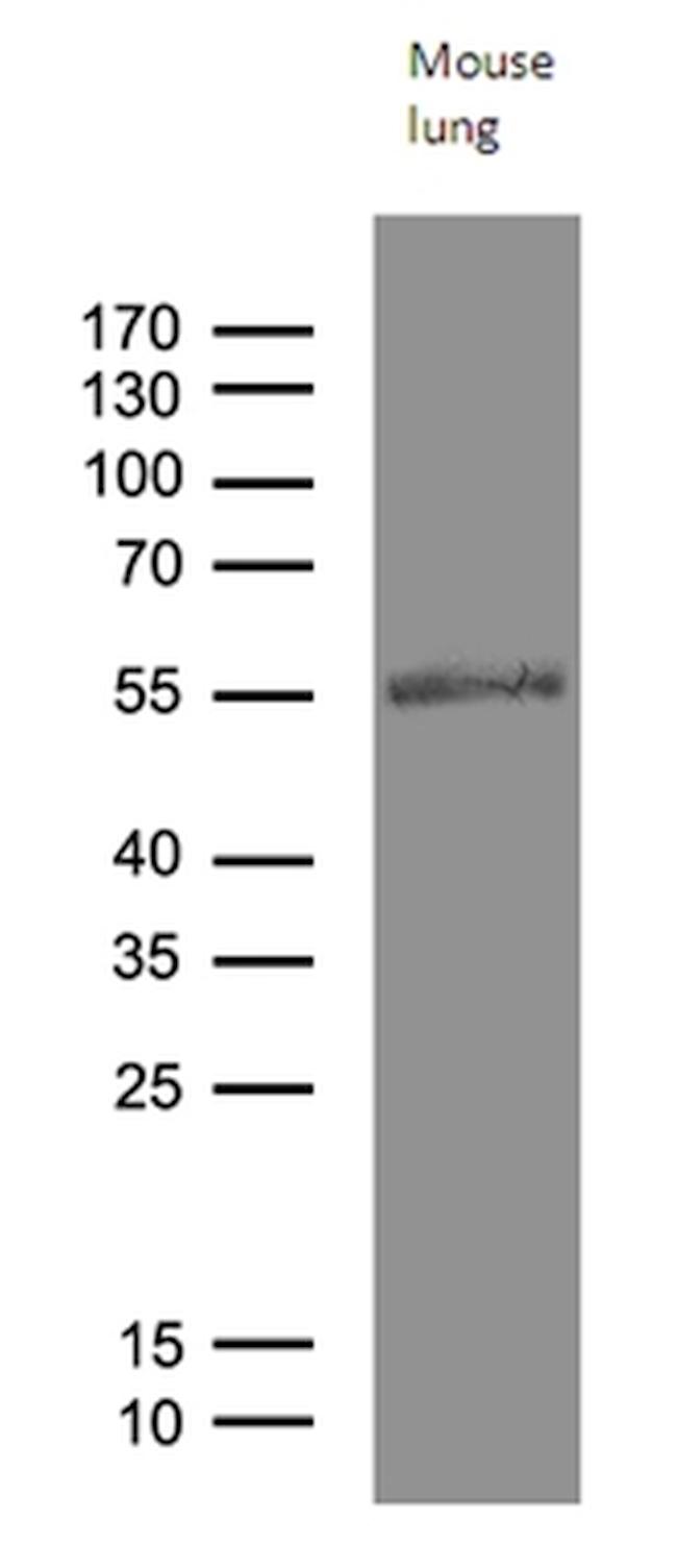 RAGE Antibody in Western Blot (WB)