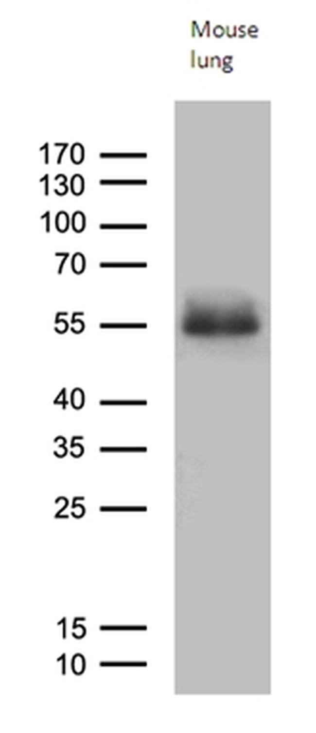 RAGE Antibody in Western Blot (WB)