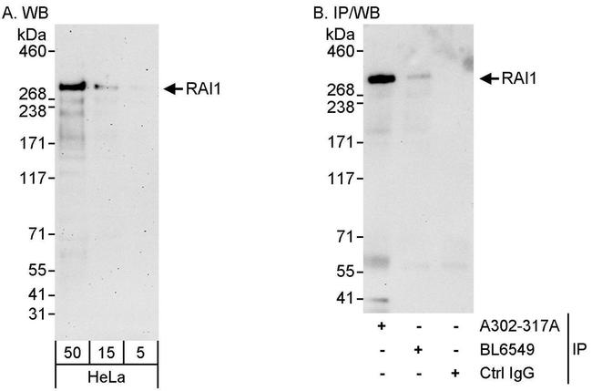 RAI1 Antibody in Western Blot (WB)